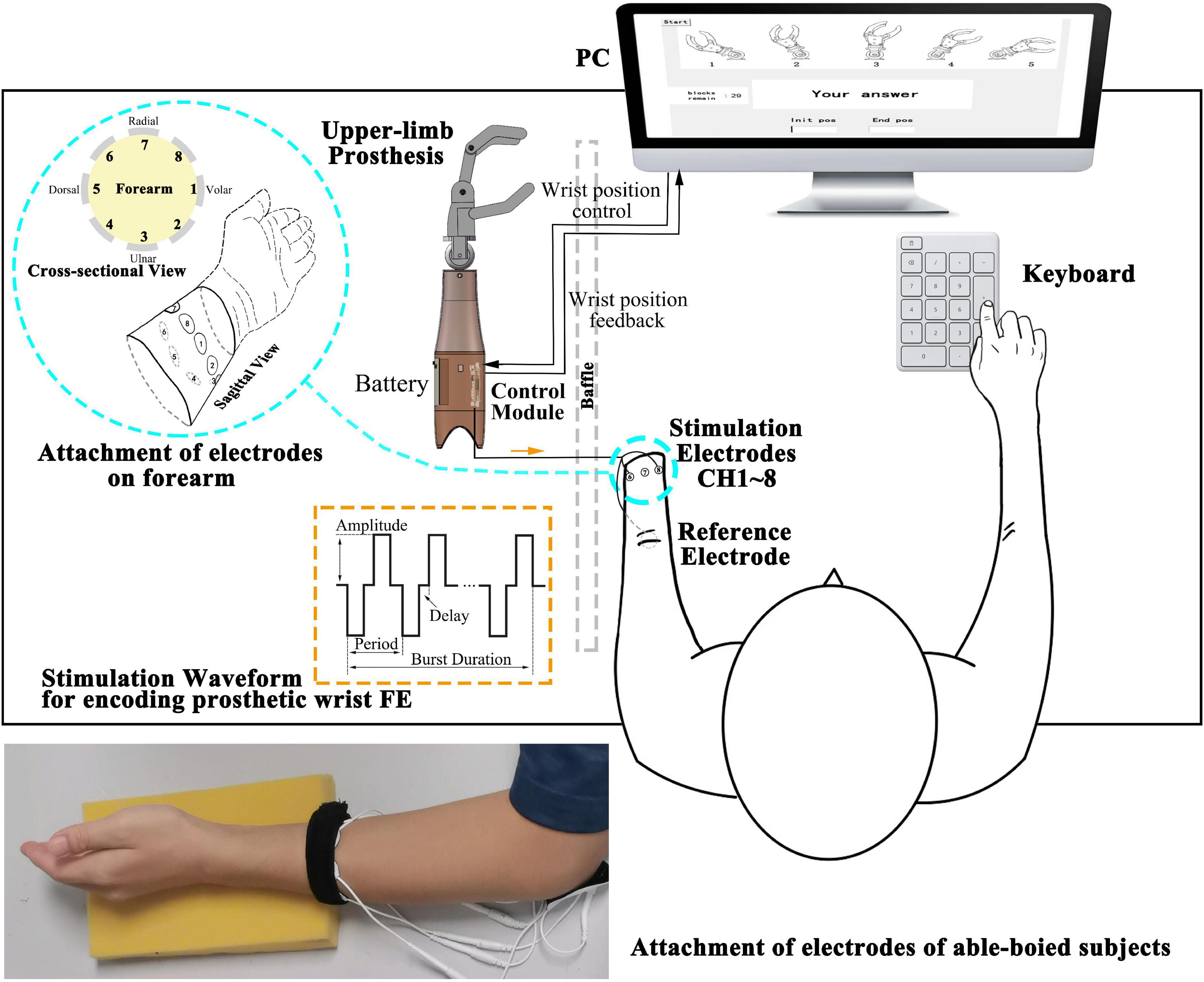 Substitutive proprioception feedback of a prosthetic wrist by electrotactile stimulation